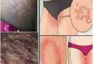 HT10. All the Symptoms of Stomach Cancer